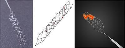 Efficacy and Safety of a Novel Thrombectomy Device in Patients With Acute Ischemic Stroke: A Randomized Controlled Trial